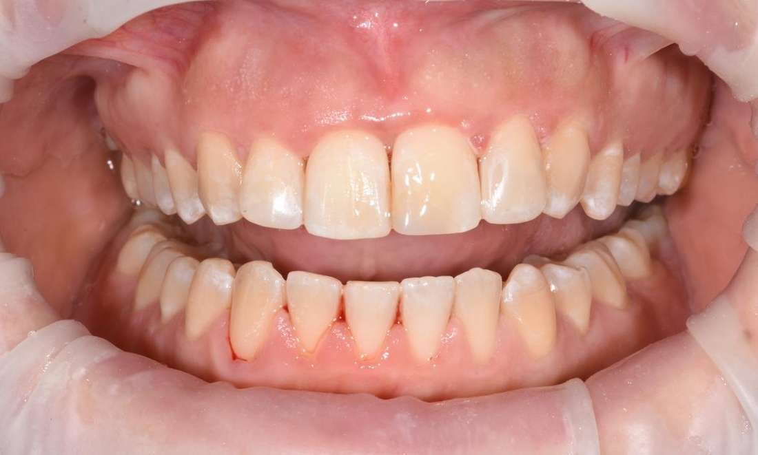 Sydney emergency dentist 
